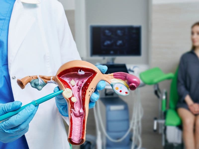 Gynecological Endocrine Disorders