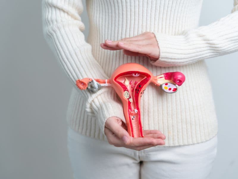 Endometriosis