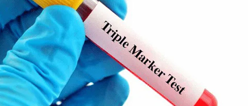 Reasons to Have a Triple Marker Test During Pregnancy